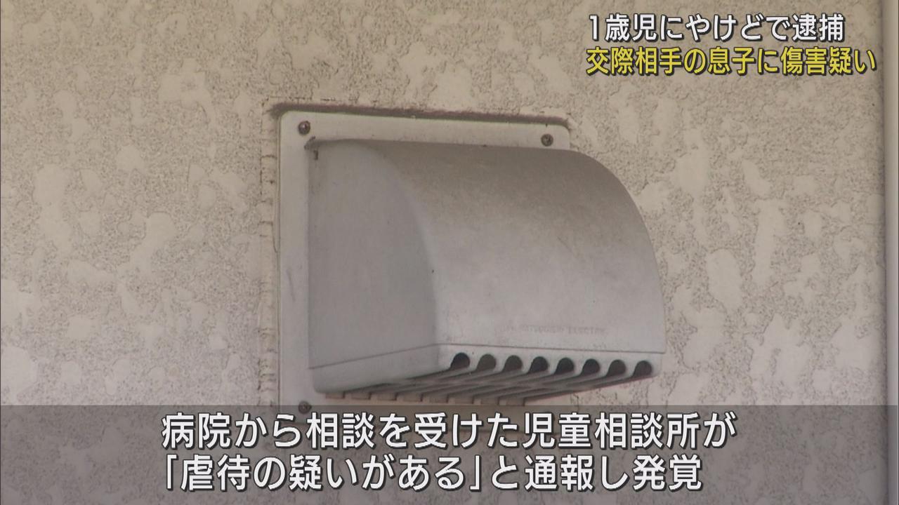 画像: 1歳の男児に全治2カ月のやけど　傷害容疑で交際相手の男を逮捕　静岡・富士市