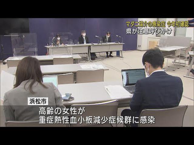 画像: 重症化すると死に至る恐れも…マダニが媒介する感染症を静岡県内で今年初めて確認　県が注意呼びかけ youtu.be