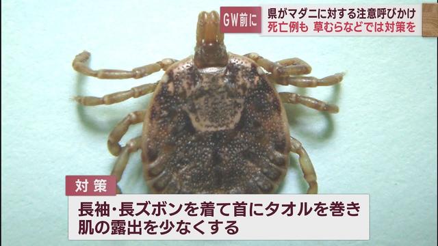 画像: 5年間で2人死亡…かまれると死に至ることも　マダニが活発になる時期迎え静岡県が注意呼びかけ youtu.be