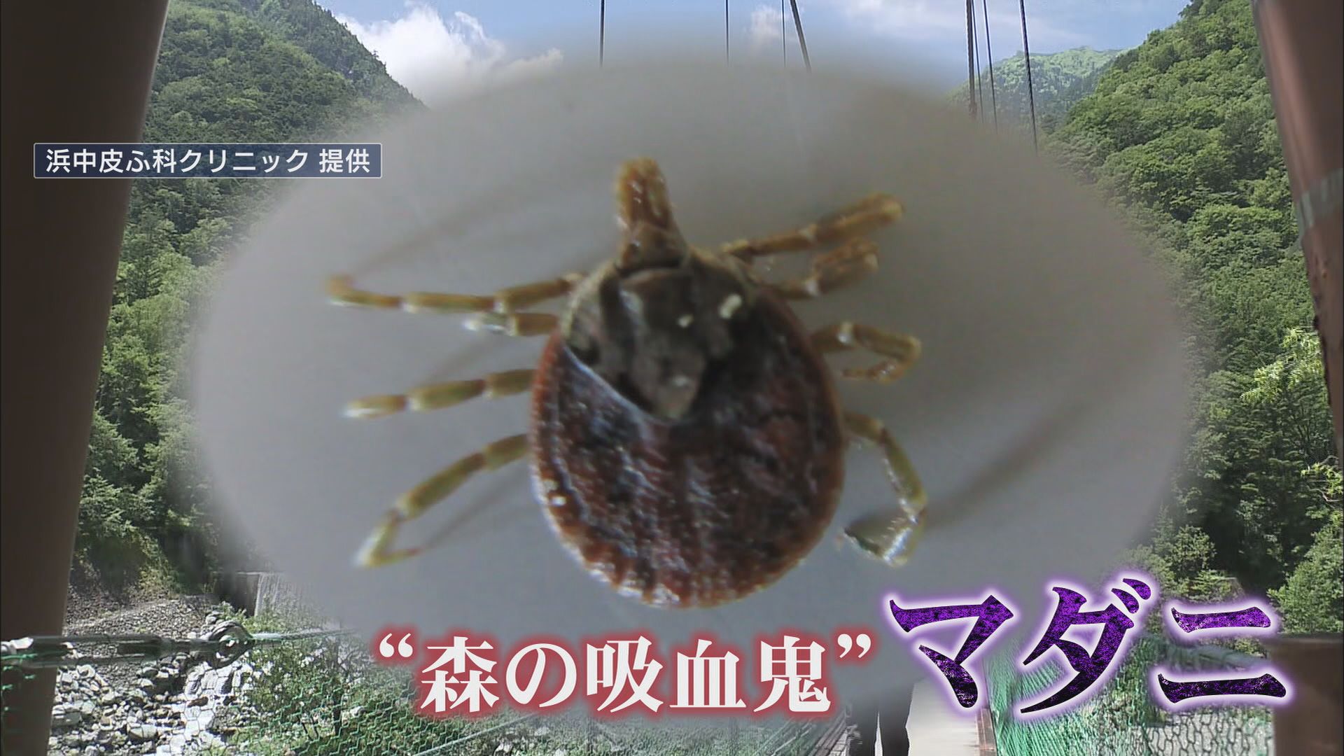 “森の吸血鬼”マダニから感染…致死率27%のSFTSが増加　野生動物から感染も　静岡県