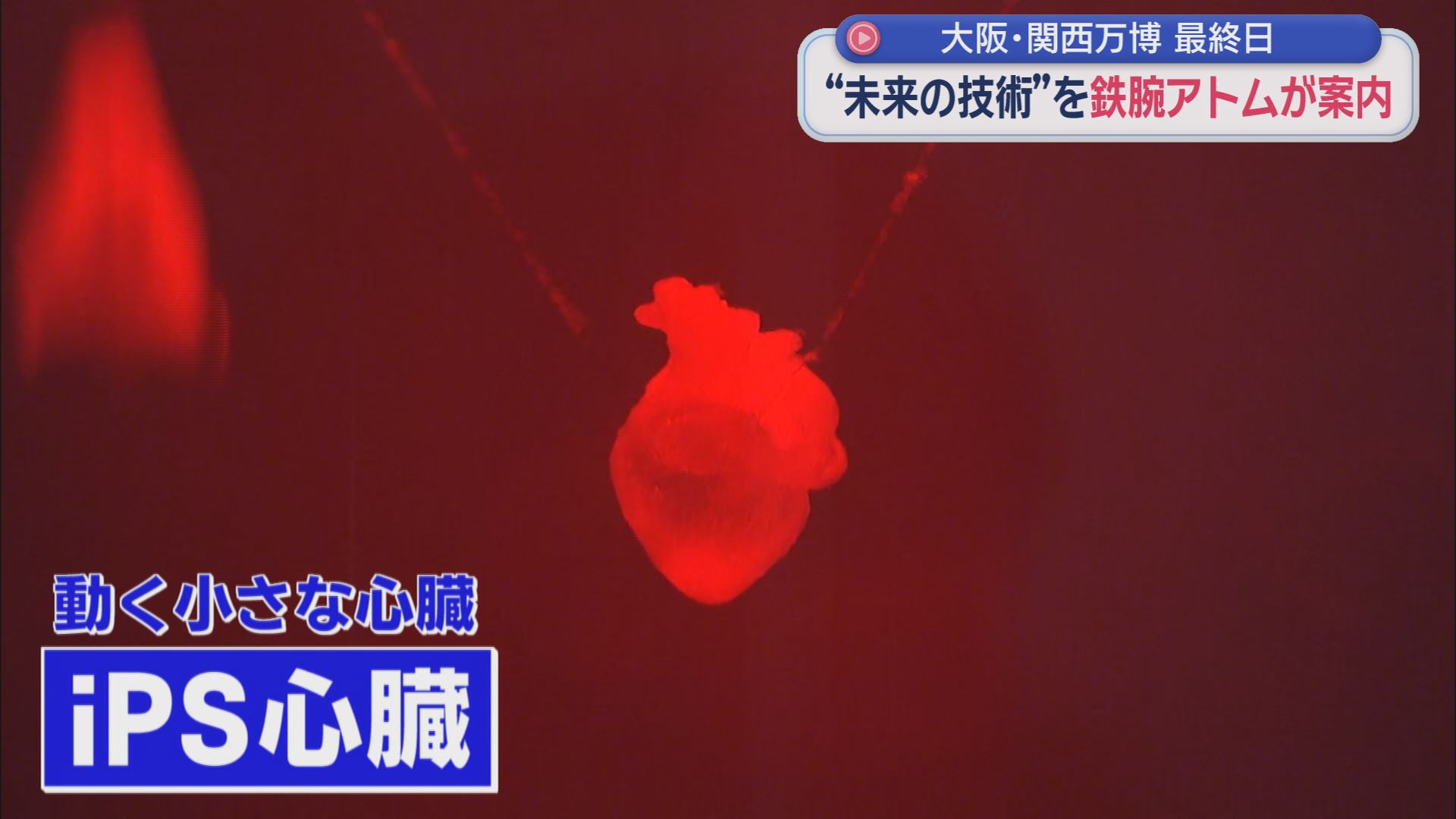 「iPS心臓」