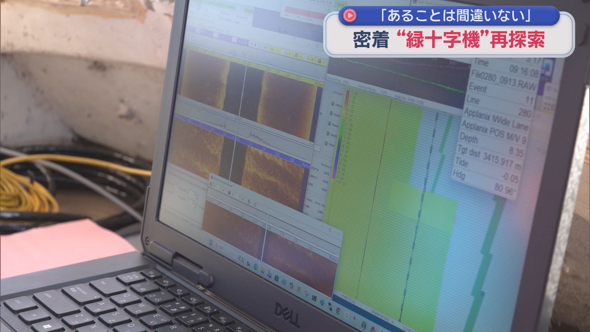 音波の反射を画像化